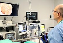 Divertículos la enfêrmëdad más frecuente del colon: síntomas, tratamientos y cómo prevenirlos (+ Detalles)