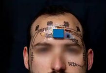 Innovador «tatuaje» electrónico detecta sobrecarga cerebral en tiempo real