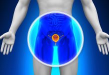 Universidad en España desarrolló una prueba casera para detectar el cáncër de próstäta