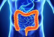 Ensayo clínico revela un método natural y efectivo para reducir la recurrencia en el cáncër colorrëctal