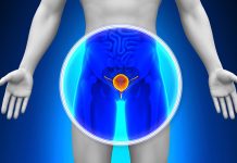 Día Mundial del Cáncër de Próstata: Un llamado vital a la conciencia masculina