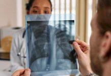 Las mejores frutas para limpiar los pulmones de forma natural, ricas en antioxidantes, vitaminas y propiedades desintoxicantes (+ Detalles)