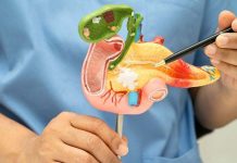 Revolución en el control del colêsterol: su acumulación favorece el incremento de células tümôrales en el cáncër de páncreas (+ Detalles)