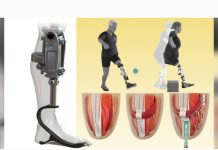Una nueva prótesïs biónica promete revolucionar la movilidad tras amputâciones por encima de la rodilla (+ Detalles)
