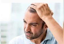 El verdadero daño de la alopecïa está en la cabeza pero no es la pérdida de cabello (+ Detalles)