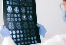 La pandemiä del Cövid-19 provocó el aumento del envejecimiento cerebral prematuro, según estudios