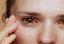 Síndromë de Sjögrën: más allá de la sequedad es una enfermedäd autoinmune silenciosa que muchas personas desconocen