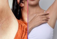 ¿Axilas oscuras? El remedio casero con dos ingredientes para aclararlas de forma natural que te sorprenderá (+ Detalles)