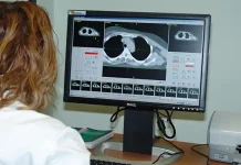 La IA mejora la predicción de recaídas en pacientes con cáncër, permitiendo a los profesionales actuar más rápido y con mayor fiabilidad (+ Detalles)