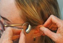 ¡Gran avance! Logran por primera vez devolver la audición a personas con sordera congénita