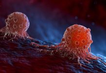 Científicos chinos en terapia celular consiguen resultados prometedores contra el cáncër (+ Detalles)