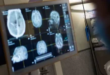 Investigadores españoles crean el primer atlas cerebral transdiagnóstico para trastörnos mentales (+ Detalles)