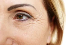 Cómo quitar las patas de gallo: este es el mejor remedio casero para las arrugąs de los ojos (+ Detalles)