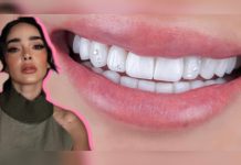 Manelyk nos deja sin palabras con su impactante cambio: ¡Así luce la nueva sonrisa de la reina de los reality shows!