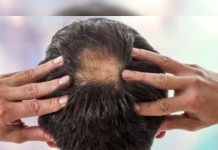 Descubre el remedio casero fácil, rápido y natural que ayuda a prevenir la caída del cabello y fortalece el crecimiento capilar
