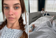 La modelo Bárbara Palvin sorprendió a sus fans al somĕtersĕ a una cirugíă de urgĕnciă (+ Foto)