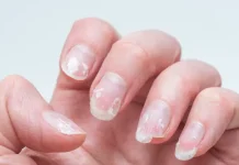 Adiós uñas escamadas: cómo recuperar su aspecto saludable y que vuelvan a crecer sanas y fuertes (+ Detalles)