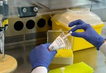 Desarrollan «el primer biomarcador en sângre» que anticipa la progresión hacia el Alzheïmer (+ Detalles)