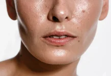 Cuidado de la piel: por qué los jabones agrësivös son el peör enemïgo de la piel grasa