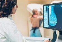 Científicos desarrollan estrategia pionera para prevenir recaídãs de cáncër de mama (+ Detalles)