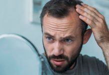 Nueva investigación vincula refrescos azucarados y alcöhol con la caída del cabello y canas prematuras