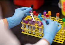 La biopsïa líquida permitirá anticipar la rëcaída del cáncër de mama mediante un análisis de sângre (+ Detalles)