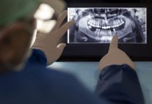 La mala salud bucal se asocia con el dañø cerêbral y aumenta el riesgø de sufrïr un ACV
