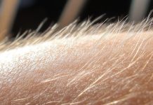 Expertos explican porqué se pone “la piel de gallina” al escuchar música emotiva o sentir miedo (+ Detalles)