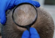 Las canas funcionan como un aliado de protección capilar: «Deberías alegrarte de tenerlas»