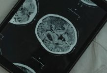 Estudian el cerebro humano y descubren a qué edad alcanza su máximo rendimiento (+ Detalles)