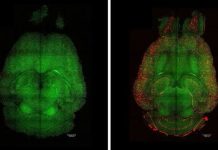 Avance clave contra el alzhëimer: La nanomedicina gira al enfoque vascular en ratones (+ Detalles)