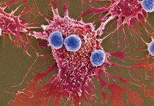 Investigación abre nuevas vías para el tratamiento del cáncër con proteínas bactërianas