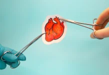 Científicos desarrollan «Parche» de tejido cardíaco cultivado para reparar el miocardio sin necesidad de cirugía a corazón abierto
