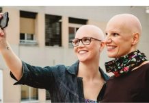 La calvïcie como un tabú: «No es lo mismo perder el cabello siendo mujer, que siendo hombre»