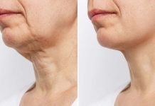 La huella visible que deja el tiempo en nuestro cuerpo: cómo suavizar las arrügas del cuello y recuperar la firmeza de la piel rápidamente en casa