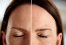 Cuidados sencillos que ayudan a suavizar las arrugas y atenuar líneas de expresión de forma natural