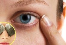 Envejêcimiento debajo de los ojos: conoce remedios naturales con cosas que están a tu lado para eliminar y aclarar las ojerąs