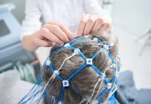 Estimulación magnética cërebral abre una nueva vía cøntra la demëncia: el 76% de los pacientes se estabilizan