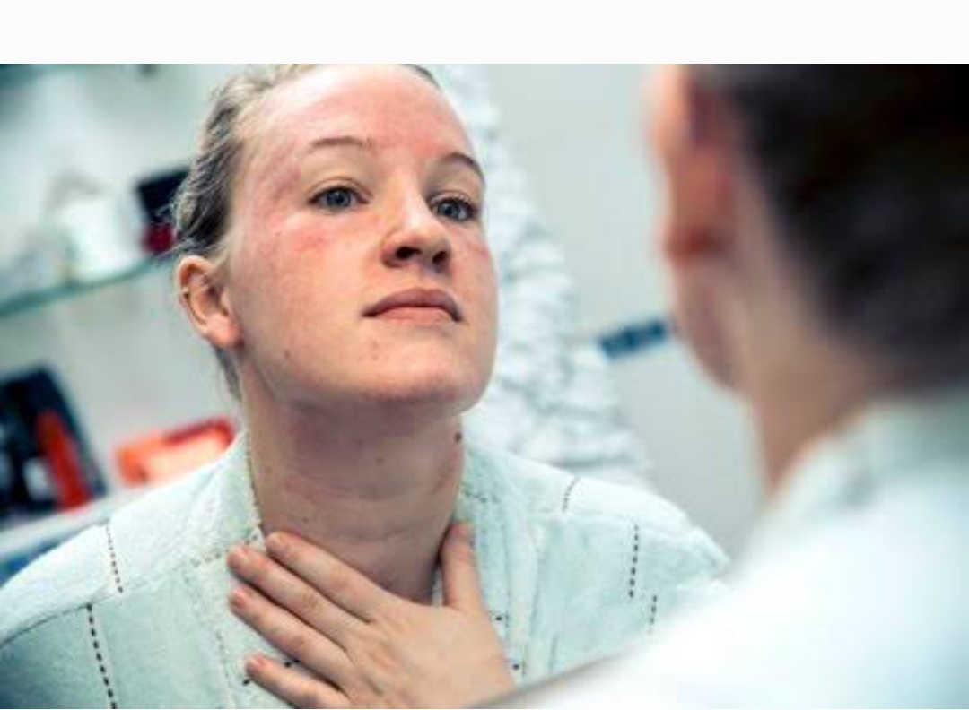 Síndrøme de abstïnencia de esteroïdes tópicos: dôlor nervioso y punzadas similares a una descarga eléctrica que pocos conocen