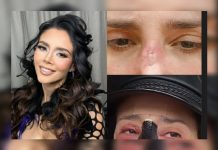 El lamęntable caso de mäla praxis de Dorismar Kerchen, pesentadora de televisión ¿Qué se sabe?