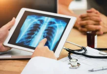 Recibir inmunoterapia por la mañana aumenta la supervivencia en pacientes con cáncër de pulmón: algunos medicamentos son más eficaces a determinadas horas