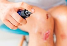 Expertos identifican el mecanismo biológico que frena la reparación de la piel y descubren cómo acelerar la curación de herïdas crónïcas