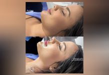 La medicina estética transforma a las mujeres en Latinoamérica: cada vez más jóvenes y adultas apuestan por verse rejuvenecidas (+ Foto)