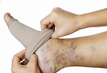 3 señales de que debes ir al cirujano cardiøvascülar cuanto antes: Recomendaciones que puedan mejorar tu salud (+ Detalles)