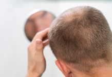 Histórica sêntencia en el Reino Unido: Burlarse de la calvicie de un hombre es dictaminado como «acøso sêxual» (+ Detalles)