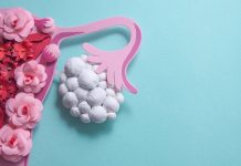 Síndrøme de ovârio pøliquístico: una entidad extremadamente frecuente, que sigue pasando desapercibida