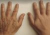 La verdad detrás del envejecimiento de las manos: por qué delatan la edad antes que el rostro