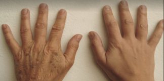 La verdad detrás del envejecimiento de las manos: por qué delatan la edad antes que el rostro