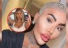 Fallêció Jordan James Parke, influencer conocido como el “Rey de los labios”: se hizo 50 cirugías para parecerse a Kim Kardashian