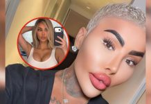 Fallêció Jordan James Parke, influencer conocido como el “Rey de los labios”: se hizo 50 cirugías para parecerse a Kim Kardashian